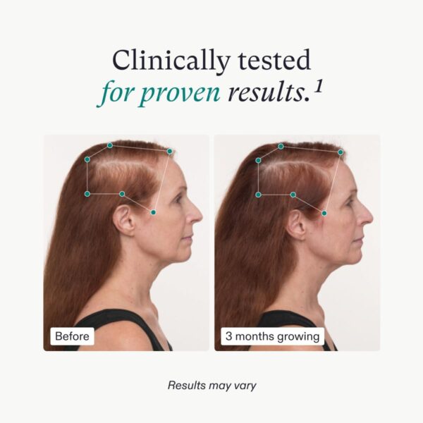 Nutrafol Women's Balance Hair Growth Supplements - Image 9